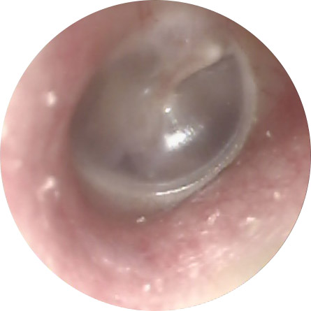 Ear Problems | ENT Specialist Surgeon Adelaide | Paul Varley ENT