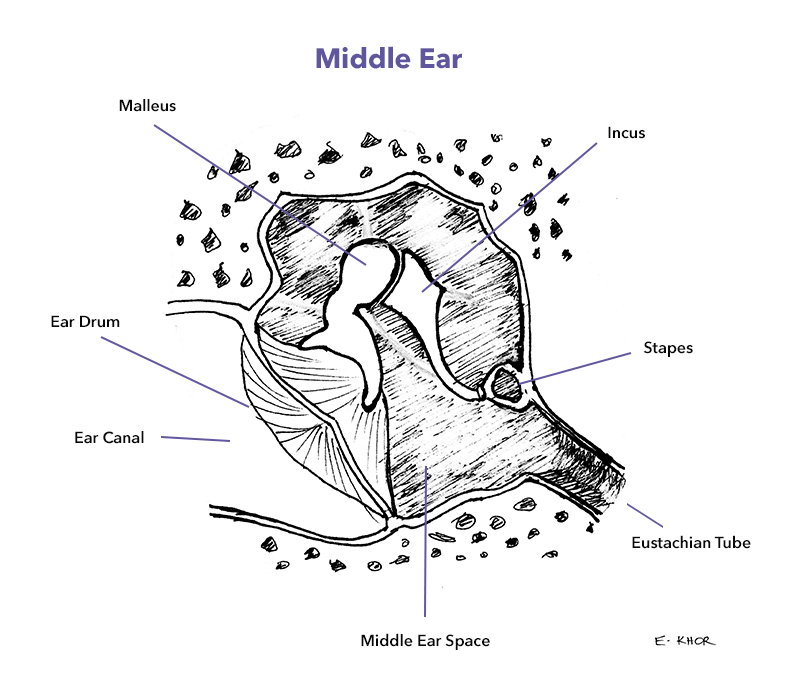 Stapedectomy of the Stapes of the Ear - Labelled – Medical Stock