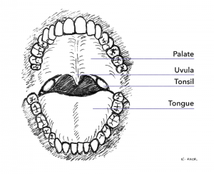 Tonsillectomy in Adults